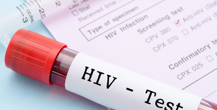 hiv