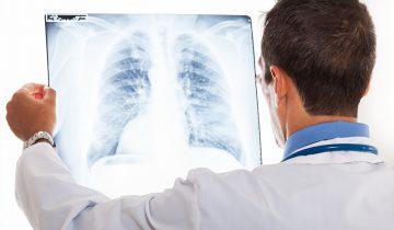 190515145709_lungs