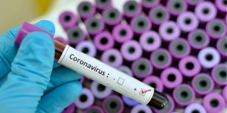 coronavirus