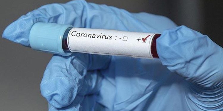 coronovirus